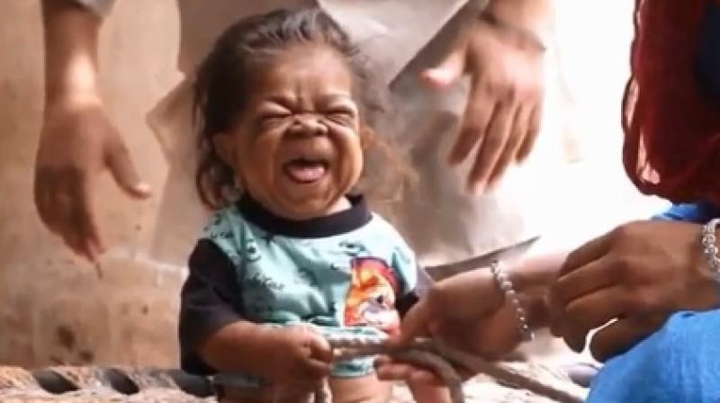 Scientists suspect Manpreet may have a rare condition called Laron Syndrome (Photo: YouTube) Scientists suspect Manpreet may have a rare condition called Laron Syndrome (Photo: YouTube)