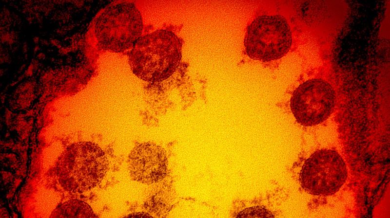 The arrival of the latest South African variant indicates that India has, at present, all the three variants: B.1.1.7 which was first found in the UK; B.1.351, which is now spreading in South Africa; and P.1, discovered in Brazil. (AFP PHOTO /NATIONAL INSTITUTE OF ALLERGY AND INFECTIOUS DISEASES/HANDOUT) The arrival of the latest South African variant indicates that India has, at present, all the three variants: B.1.1.7 which was first found in the UK; B.1.351, which is now spreading in South Africa; and P.1, discovered in Brazil. (AFP PHOTO /NATIONAL INSTITUTE OF ALLERGY AND INFECTIOUS DISEASES/HANDOUT)