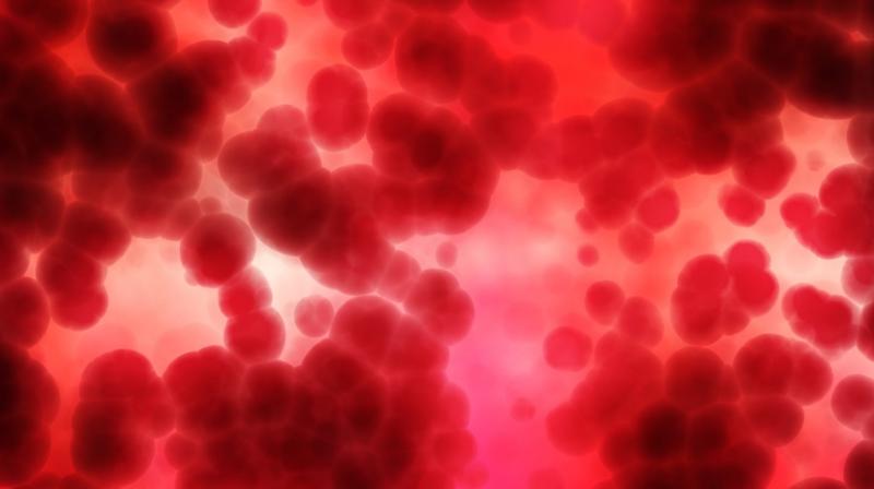 Meanwhile, new treatment regimes, such as immunotherapy, are not as widely used due to their prohibitive costs. Meanwhile, new treatment regimes, such as immunotherapy, are not as widely used due to their prohibitive costs.
