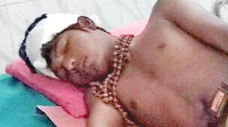 The injured boy, Karthikeyan*. The injured boy, Karthikeyan*.