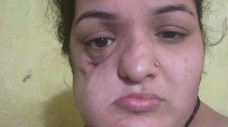 Faiza Tanveer, 25, is suffering from a recurrent ameloblastoma, an oral tumour. (Photo: Twitter | @FaizaTanveer8) Faiza Tanveer, 25, is suffering from a recurrent ameloblastoma, an oral tumour. (Photo: Twitter | @FaizaTanveer8)