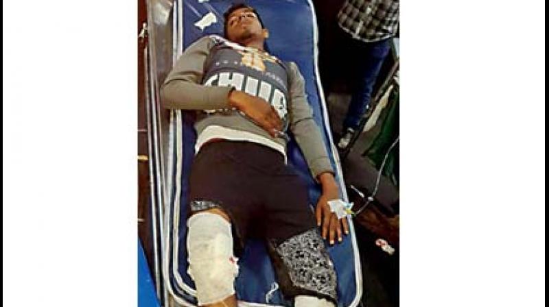 Syed Suhail being treated at Bowring hospital after he was shot in the leg by the police, on Monday. (Photo:DC) Syed Suhail being treated at Bowring hospital after he was shot in the leg by the police, on Monday. (Photo:DC)