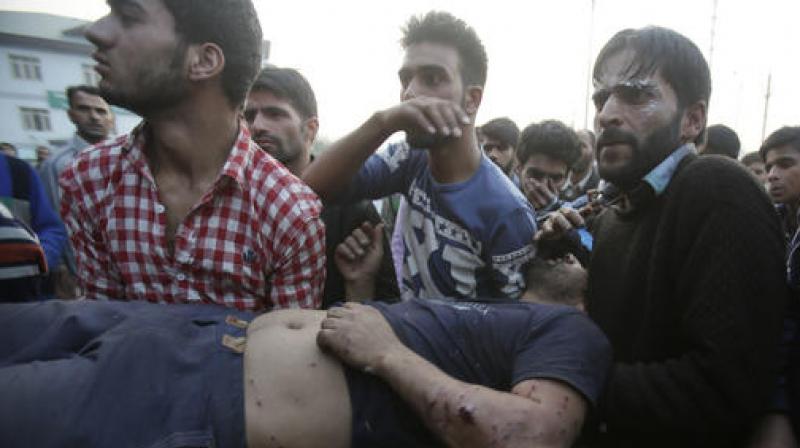 An injured Kashmiri man is brought for treatment to a hospital in Srinagar. (Photo: PTI) An injured Kashmiri man is brought for treatment to a hospital in Srinagar. (Photo: PTI)
