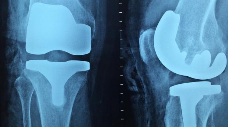 Ease joint pain with these tips. (Photo: Pixabay) Ease joint pain with these tips. (Photo: Pixabay)