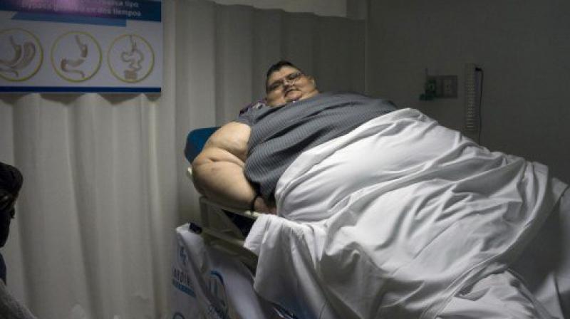 Worlds Fattest Man Has Resolution To Reduce Weight By Half This Year 