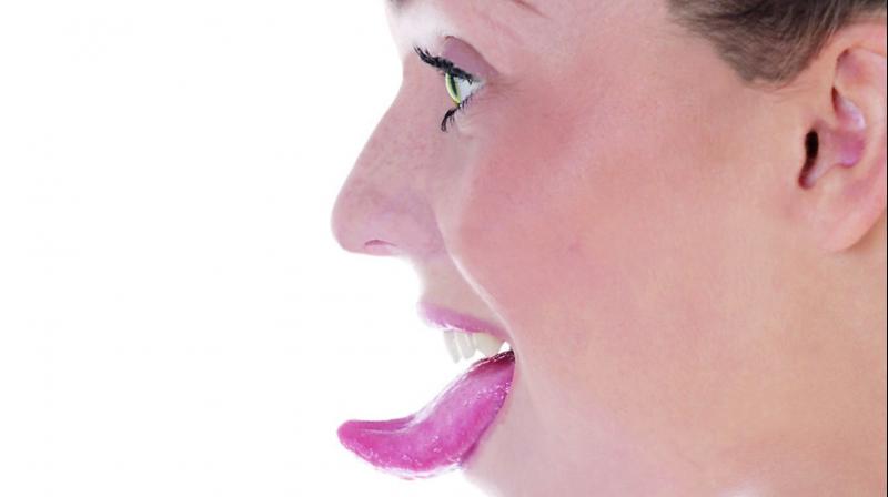 Many people develop cancer sores on the tongue which normally heal within a week or two of treatments, Many people develop cancer sores on the tongue which normally heal within a week or two of treatments,