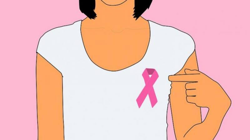 Misconceptions lead women to avoid breast cancer radiation therapy. (Photo: Pixabay) Misconceptions lead women to avoid breast cancer radiation therapy. (Photo: Pixabay)