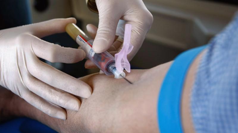Autism May Be Detectable In Blood >> Autism Can Be Detected Years In Advance By New Blood Test Autism May Be Detectable In Blood >> Autism Can Be Detected Years In Advance By New Blood Test