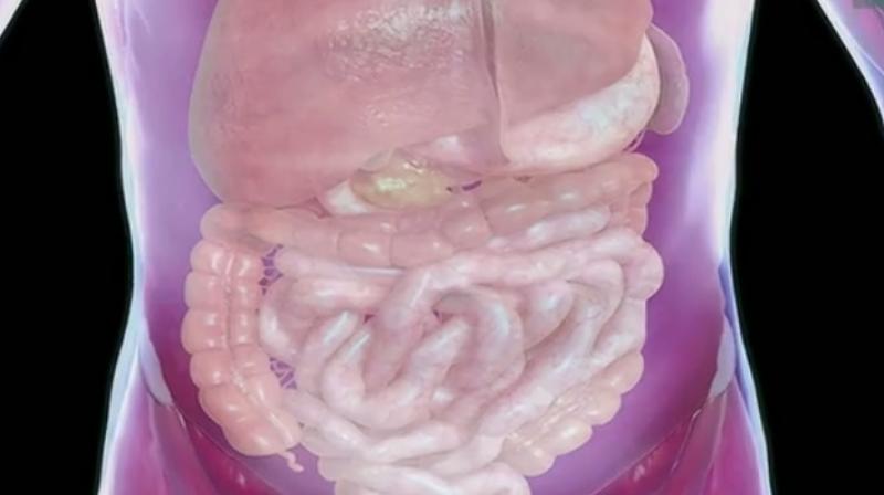 The mesentery, which connects the intestine to the abdomen, had for hundreds of years been considered a fragmented structure made up of multiple separate parts. (Credit: YouTube) The mesentery, which connects the intestine to the abdomen, had for hundreds of years been considered a fragmented structure made up of multiple separate parts. (Credit: YouTube)