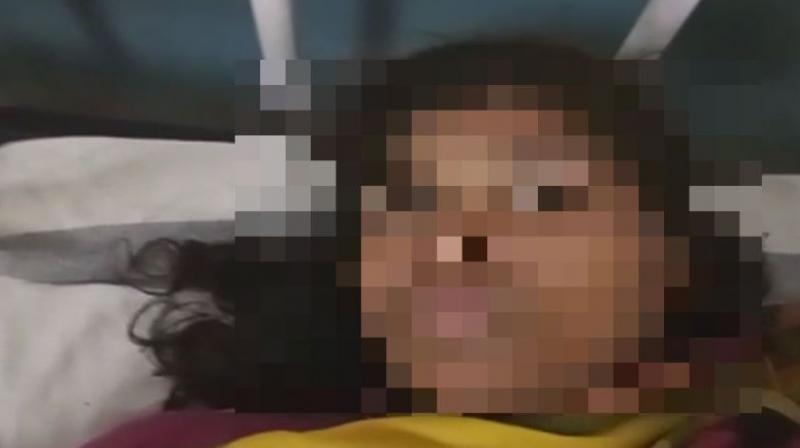 The victim is undergoing treatment at a nearby hospital and her condition was said to be stable. (Photo: Twitter | ANI) The victim is undergoing treatment at a nearby hospital and her condition was said to be stable. (Photo: Twitter | ANI)