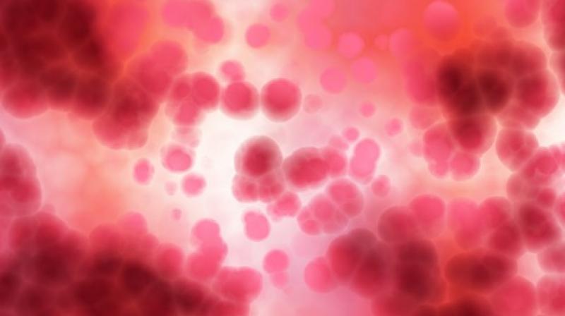 Researchers may have found new technique to prevent cancer cells from multiplying. (Photo: Pixabay) Researchers may have found new technique to prevent cancer cells from multiplying. (Photo: Pixabay)