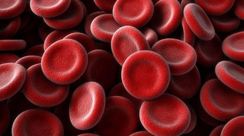 The "ground breaking" 'liquid biopsy' blood test promises to speed up the diagnosis of melanoma, ensuring patients get the personalised treatment they need sooner. (Representational Image) The "ground breaking" 'liquid biopsy' blood test promises to speed up the diagnosis of melanoma, ensuring patients get the personalised treatment they need sooner. (Representational Image)
