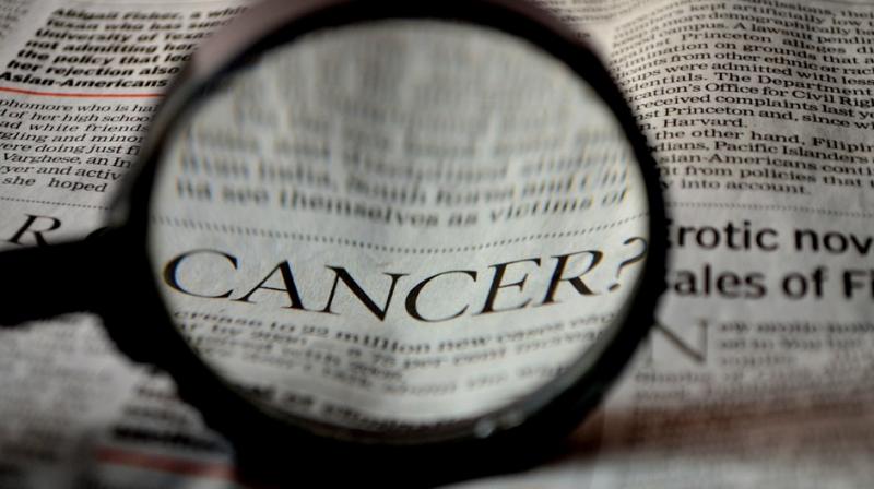 Liver tumours develop from mutated cells that grow and proliferate uncontrollably. (Photo: Pixabay) Liver tumours develop from mutated cells that grow and proliferate uncontrollably. (Photo: Pixabay)