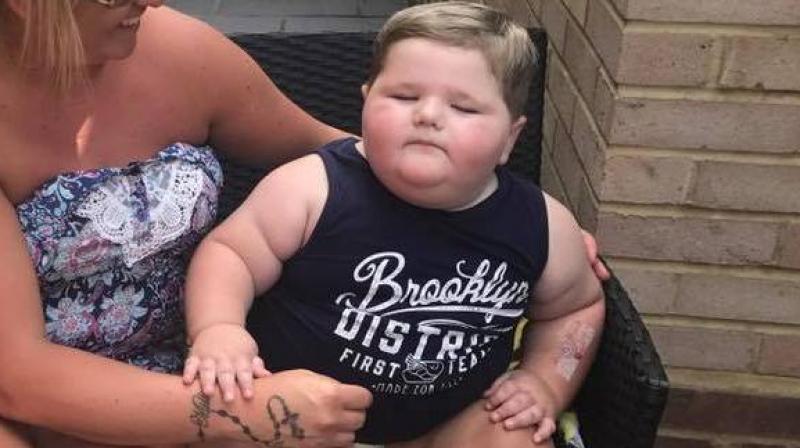 The fat in his body is already taking a toll on his liver and heart (Photo: Facebook/Abby Clare Hunt) The fat in his body is already taking a toll on his liver and heart (Photo: Facebook/Abby Clare Hunt)