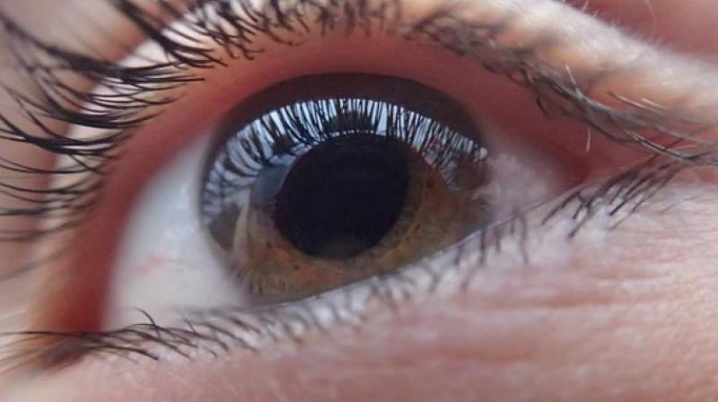 It was found that the innermost layer of the retina in one section of the eye had an average thickness of 35 microm when compared to the thickness of 37 mi.m in those who didn’t have the disease. (Photo: Pixabay) It was found that the innermost layer of the retina in one section of the eye had an average thickness of 35 microm when compared to the thickness of 37 mi.m in those who didn’t have the disease. (Photo: Pixabay)