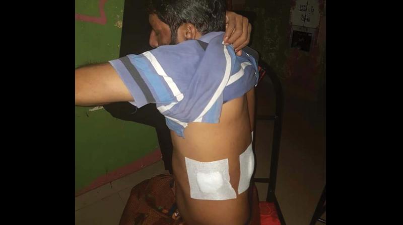 Ismail Sahib and Bashid show their injuries. Ismail Sahib and Bashid show their injuries.