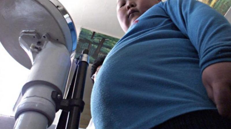 Obesity rates among children are rising. (Photo: Pixabay) Obesity rates among children are rising. (Photo: Pixabay)