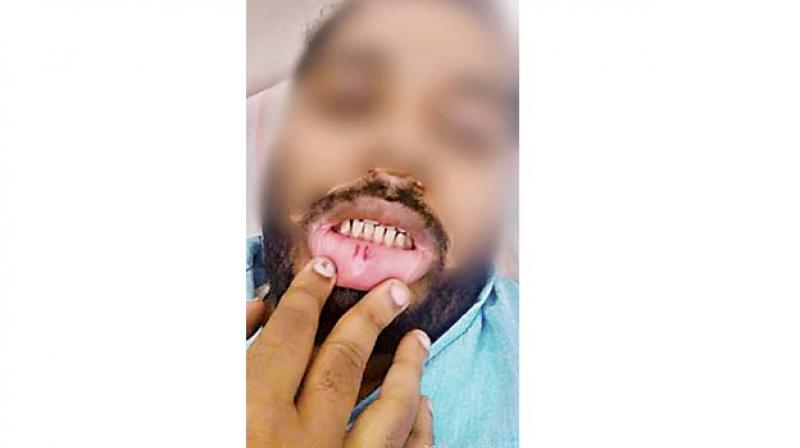 The employee who was hurt in the ordeal The employee who was hurt in the ordeal