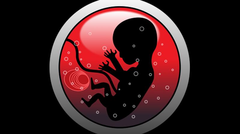 This could one day help in developing regenerative medicine therapies and new infertility treatments. (Photo: Pixabay) This could one day help in developing regenerative medicine therapies and new infertility treatments. (Photo: Pixabay)
