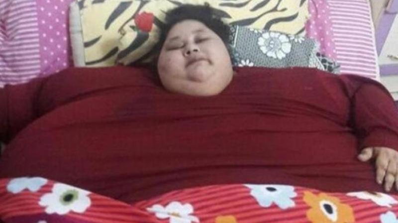 Eman weighed around 500 kg when she was brought to Mumbai's Saifee Hospital. (Photo: AFP) Eman weighed around 500 kg when she was brought to Mumbai's Saifee Hospital. (Photo: AFP)
