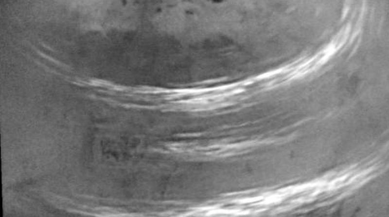 The image was taken on May 7, 2017, at a distance of 316,000 miles (508,000 kilometers). The image was taken on May 7, 2017, at a distance of 316,000 miles (508,000 kilometers).