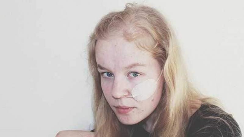 A Dutch teenager traumatised by a childhood rape died at home after refusing food and drink but was not euthanised, a minister and a clinic said on Wednesday. (Photo: Instagram/ winnenofleren) A Dutch teenager traumatised by a childhood rape died at home after refusing food and drink but was not euthanised, a minister and a clinic said on Wednesday. (Photo: Instagram/ winnenofleren)