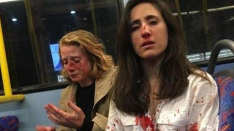 Melania Geymonat, 28, said she and her girlfriend Chris were left covered in blood after the attack last week. (Photo: Facebook/ Melania Geymonat) Melania Geymonat, 28, said she and her girlfriend Chris were left covered in blood after the attack last week. (Photo: Facebook/ Melania Geymonat)