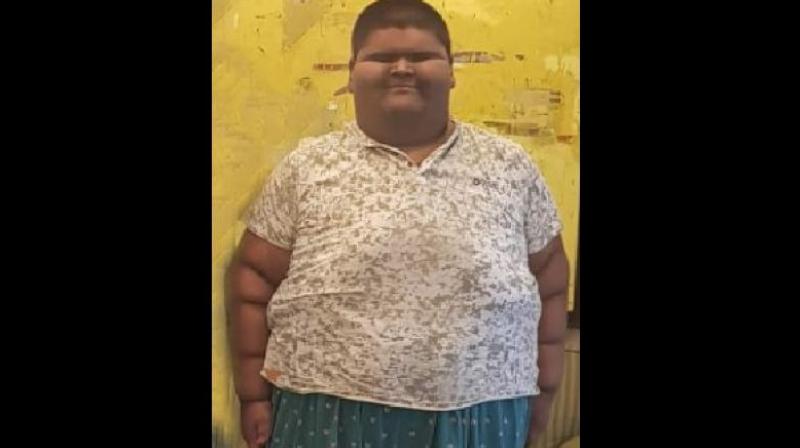 Mihir weighed 2.5 kg at birth in 2003. He first showed signs of obesity at the age of 5, weighing 60-70 kg, the hospital said. Mihir's family has a history of obesity, but the boy also had an uncontrolled diet and would consume a lot of junk food. (Photo: Facebook screengrab) Mihir weighed 2.5 kg at birth in 2003. He first showed signs of obesity at the age of 5, weighing 60-70 kg, the hospital said. Mihir's family has a history of obesity, but the boy also had an uncontrolled diet and would consume a lot of junk food. (Photo: Facebook screengrab)