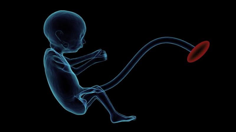 It's common in the U.S. for doctors to cut the cord almost immediately, within 15 to 20 seconds of birth, unless the baby is premature. (Photo: Pixabay) It's common in the U.S. for doctors to cut the cord almost immediately, within 15 to 20 seconds of birth, unless the baby is premature. (Photo: Pixabay)