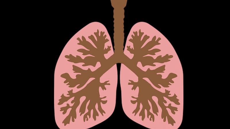 Here is how you can take care of respiratory distress. (Photo: Representational/Pixabay) Here is how you can take care of respiratory distress. (Photo: Representational/Pixabay)