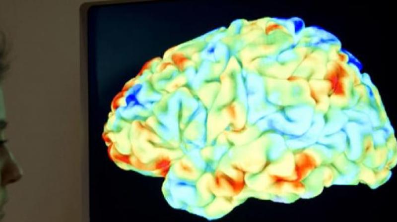 These findings show that both genetics (GBA gene mutation) and aging can cause the same lipid elevations in the brain that are demonstrated in Parkinson's disease pathology (Photo: AFP) These findings show that both genetics (GBA gene mutation) and aging can cause the same lipid elevations in the brain that are demonstrated in Parkinson's disease pathology (Photo: AFP)