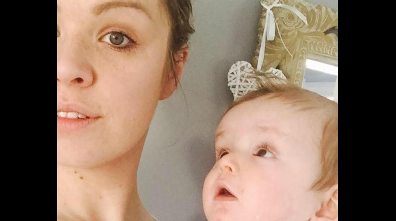 The boy’s 32-year-old mother, Katie, has to spend one-and-a-half hour every night attending to him bandaging his wounds protecting him from infection. (Photo: The boy’s 32-year-old mother, Katie, has to spend one-and-a-half hour every night attending to him bandaging his wounds protecting him from infection. (Photo:
