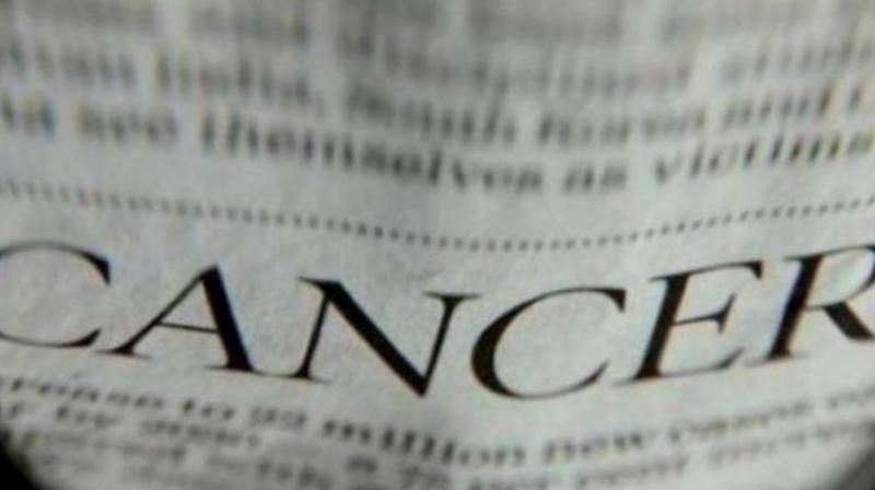 Researchers develop platform to kill cancer cells. (Photo: Pixabay) Researchers develop platform to kill cancer cells. (Photo: Pixabay)