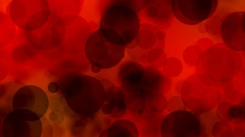 New form of immunotherapy developed could cure bowel cancer, scientists claim. (Photo: Pixabay) New form of immunotherapy developed could cure bowel cancer, scientists claim. (Photo: Pixabay)