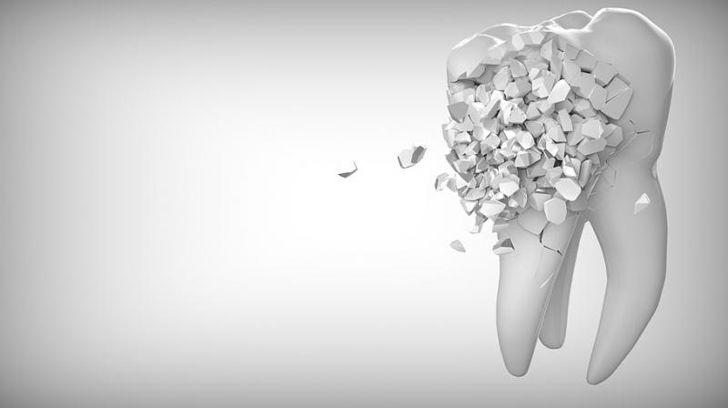 Smoking, drinking associated with dental filling failure, new study claims. (Photo: Pixabay) Smoking, drinking associated with dental filling failure, new study claims. (Photo: Pixabay)