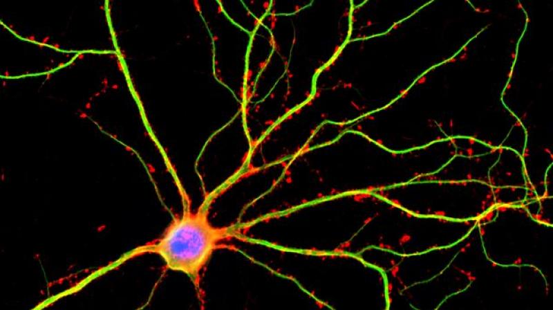 UCLA scientists discovered that dendrites (shown here in green) are not just passive conduits for electrical currents between neurons. (Image: UCLA) UCLA scientists discovered that dendrites (shown here in green) are not just passive conduits for electrical currents between neurons. (Image: UCLA)