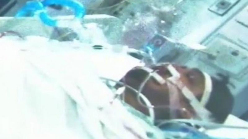 The family said Mohammed Akbar, doing his masters in computer sciences, was injured when a bullet hit his right cheek on December 6. (Photo: ANI/Twitter) The family said Mohammed Akbar, doing his masters in computer sciences, was injured when a bullet hit his right cheek on December 6. (Photo: ANI/Twitter)
