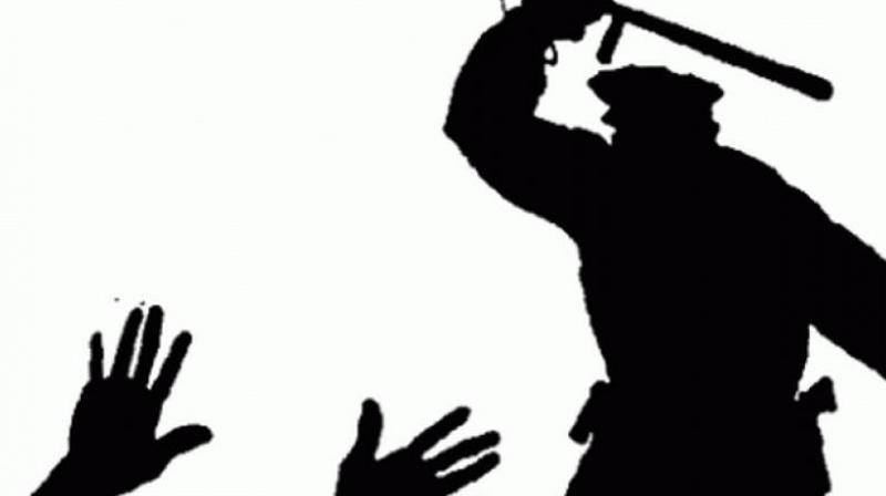 Suicide and illness are other common causes listed by the authorities. Suicide and illness are other common causes listed by the authorities.