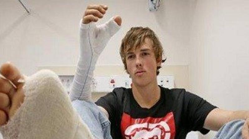 An Australian cattle worker whose thumb was severed by a bull has had his toe surgically transplanted in its position. (Photo: Twiter/@ejovip1) An Australian cattle worker whose thumb was severed by a bull has had his toe surgically transplanted in its position. (Photo: Twiter/@ejovip1)