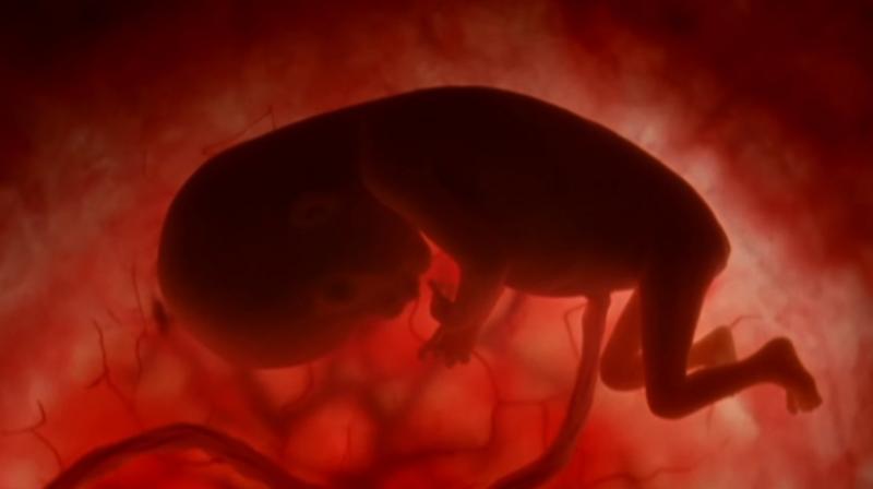 It is estimated that 68 lakh abortions occur in India every year. (Credit: YouTube) It is estimated that 68 lakh abortions occur in India every year. (Credit: YouTube)