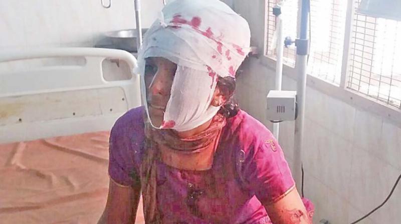 Kausalya, who escaped with injuries, had said her father was totally opposed to their relationship and threatened to act against Shankar. (Photo: DC) Kausalya, who escaped with injuries, had said her father was totally opposed to their relationship and threatened to act against Shankar. (Photo: DC)