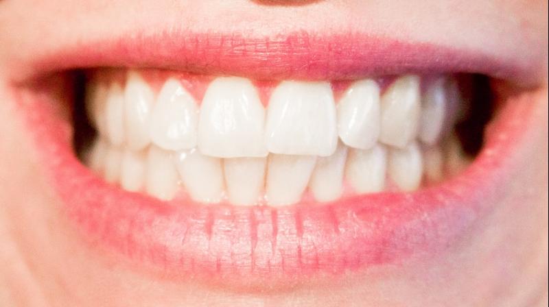 Poor oral health ups frailty risk in older men. (Photo: Pixabay) Poor oral health ups frailty risk in older men. (Photo: Pixabay)