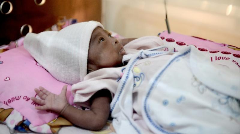 Weighing less than 2.5 kilos at birth is closely linked to high rates of neonatal mortality and ill health later in life. (Photo: AFP) Weighing less than 2.5 kilos at birth is closely linked to high rates of neonatal mortality and ill health later in life. (Photo: AFP)