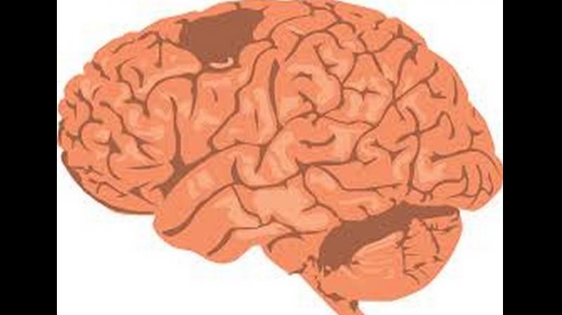 The striatum is the inner part of the brain that among other things regulates rewards, motivation, impulses and motor function. (Photo: ANI)
