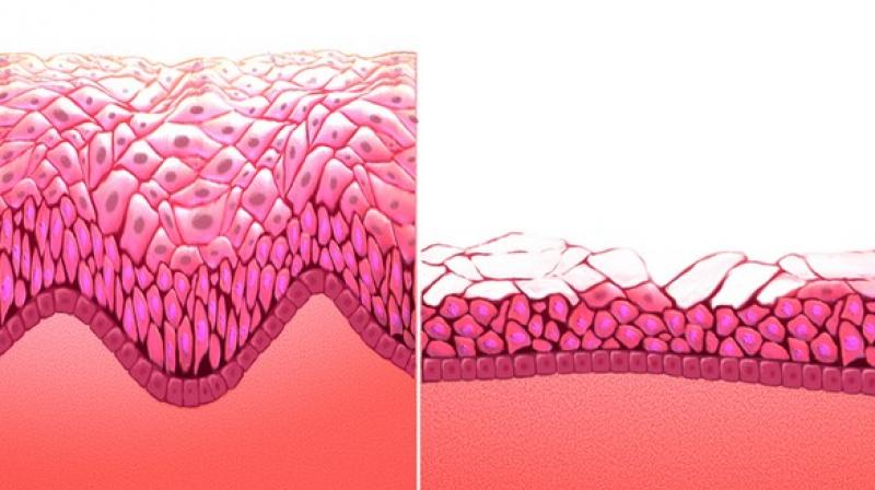 The researchers found only a small difference in menopause symptoms or age of onset between different modes of social organisation. (Photo: ANI) The researchers found only a small difference in menopause symptoms or age of onset between different modes of social organisation. (Photo: ANI)
