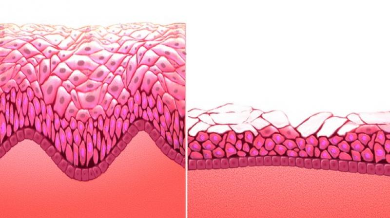 The researchers found only a small difference in menopause symptoms or age of onset between different modes of social organisation. (Photo: ANI)