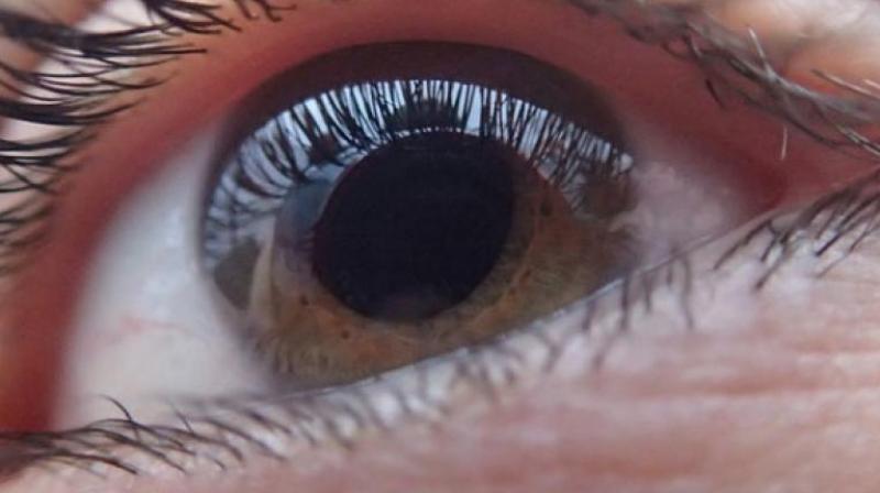 The dual focus lens were well accepted by children and did not affect their daily activities. The dual focus lens were well accepted by children and did not affect their daily activities.