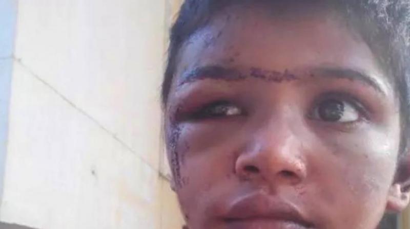 The child who was tortured in confinement by her employers (Photo: Facebook) The child who was tortured in confinement by her employers (Photo: Facebook)