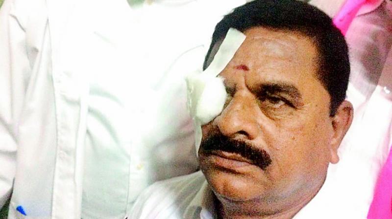 Swamy Goud being treated after he was injured in the Assembly. Swamy Goud being treated after he was injured in the Assembly.