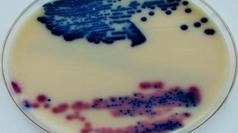 The test is supposed to ensure that the patient actually has a UTI and that the right antibiotic is prescribed to treat it. (Photo: ANI) The test is supposed to ensure that the patient actually has a UTI and that the right antibiotic is prescribed to treat it. (Photo: ANI)